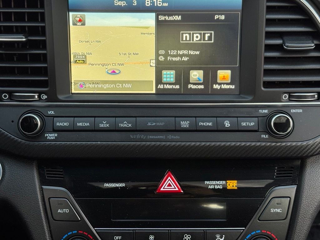 2018 Hyundai Elantra Sport